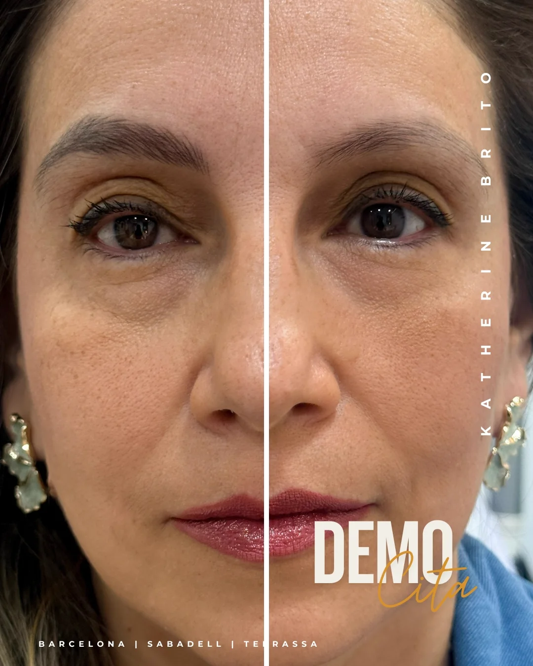 Microblading antes y después resultado real — Katherine Brito Barcelona