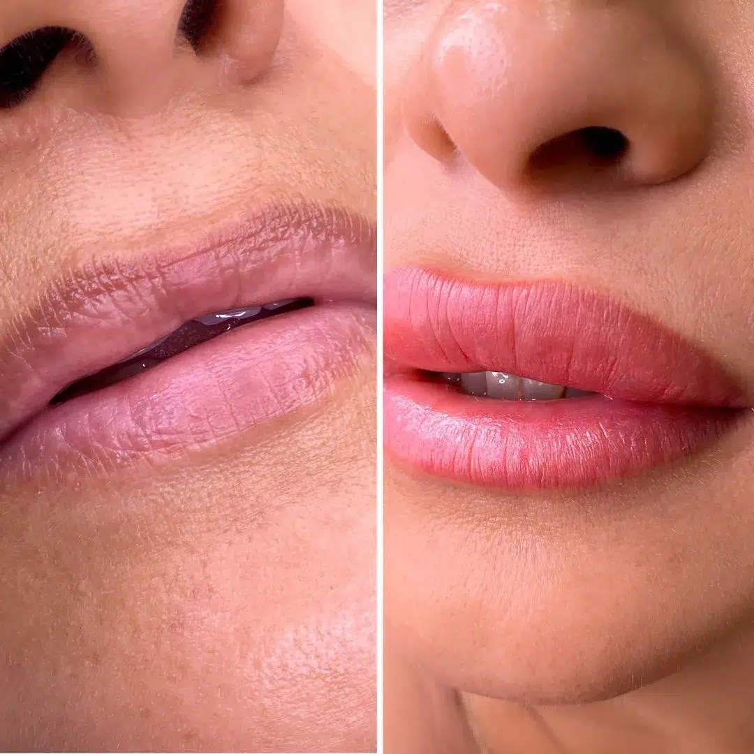 Detalle de contorno de labios micropigmentado en Barcelona