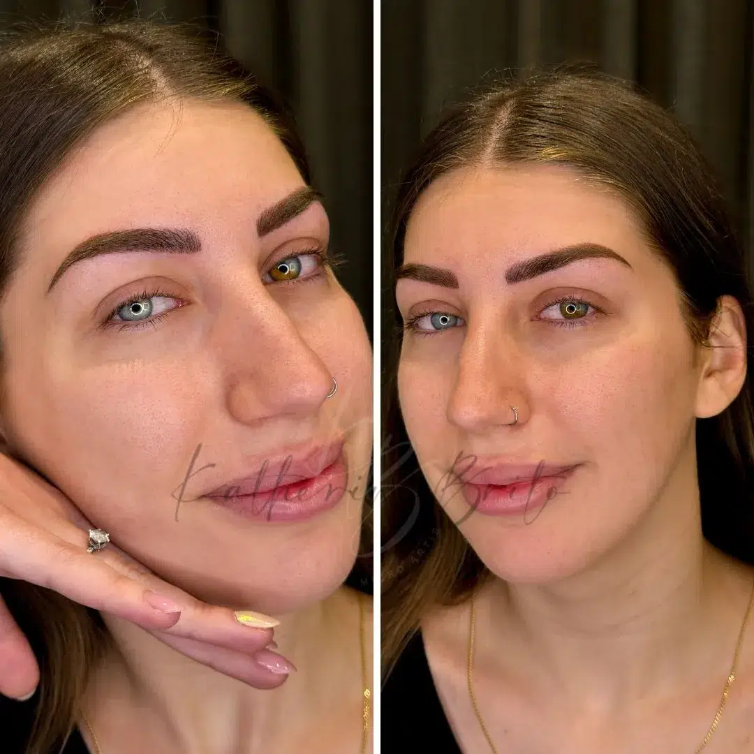 Armonía facial con microblading en Barcelona.
