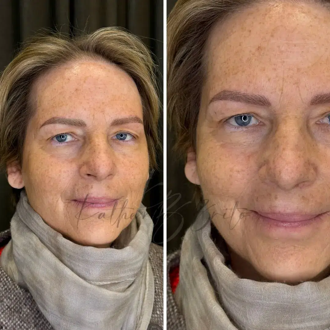De cejas finas a equilibradas con microblading pelo a pelo