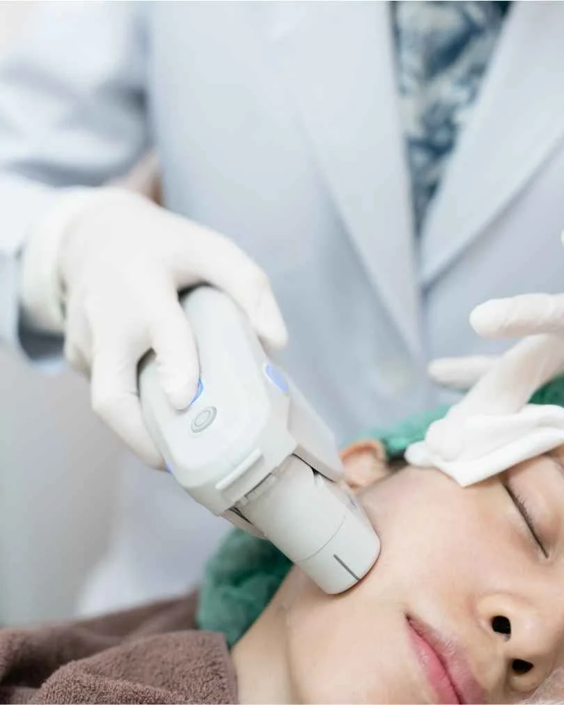HIFU facial en Barcelona